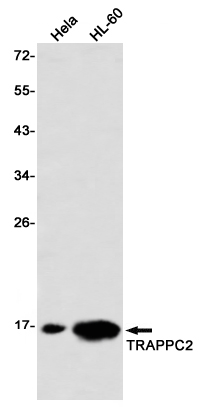 Rabbit Monoclonal Antibody to TRAPPC2