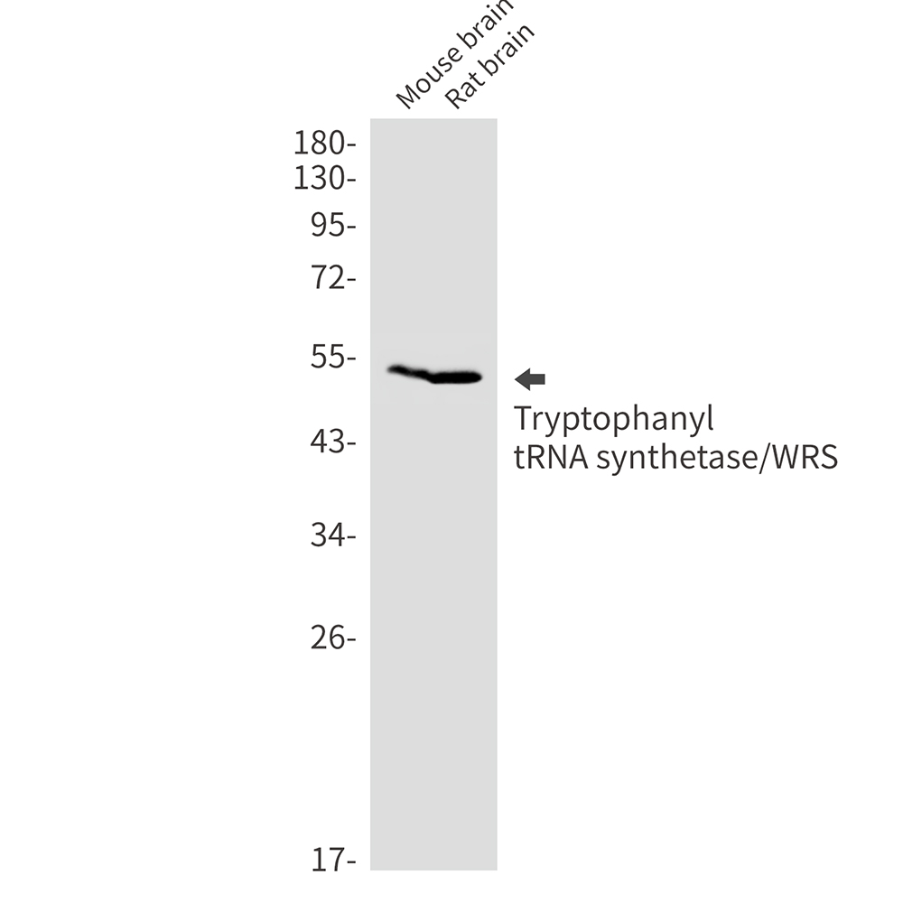 Rabbit Monoclonal Antibody to Tryptophan tRNA Ligase
