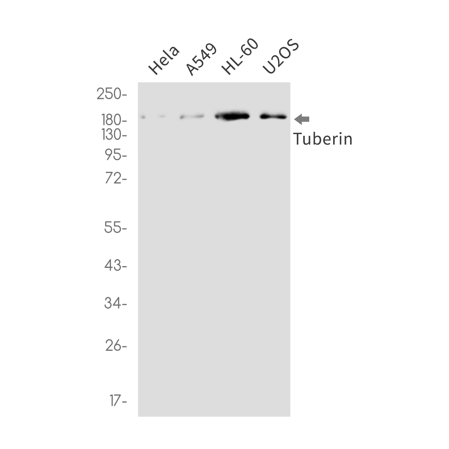 Rabbit Monoclonal Antibody to Tuberin