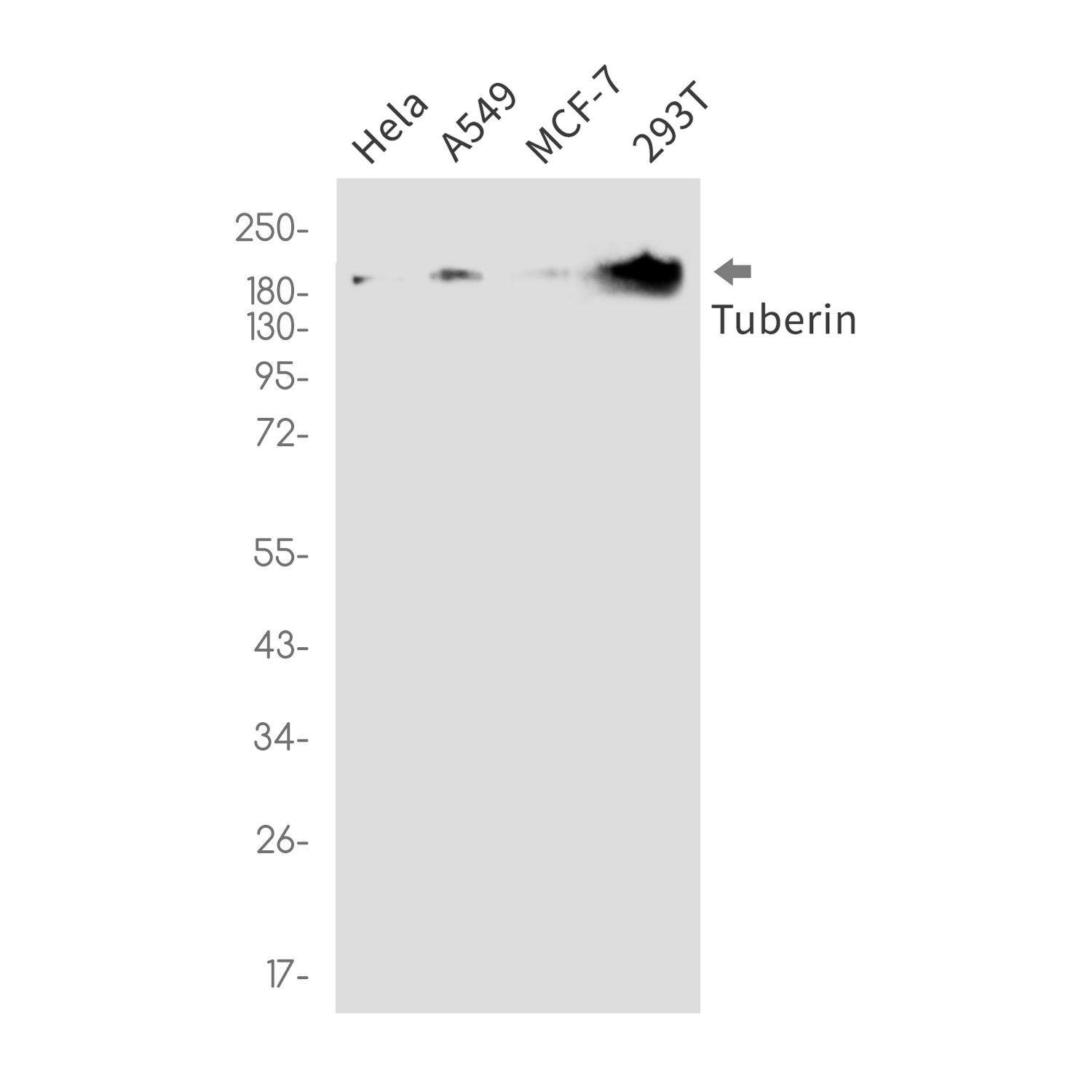 Rabbit Monoclonal Antibody to Tuberin