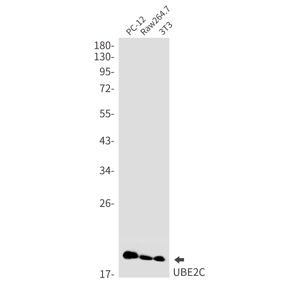 Rabbit Monoclonal Antibody to Ubiquitin Conjugating Enzyme E2 C