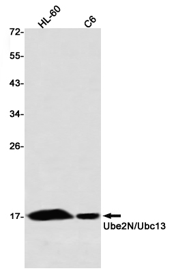 Rabbit Monoclonal Antibody to Ubiquitin Conjugating Enzyme E2 N
