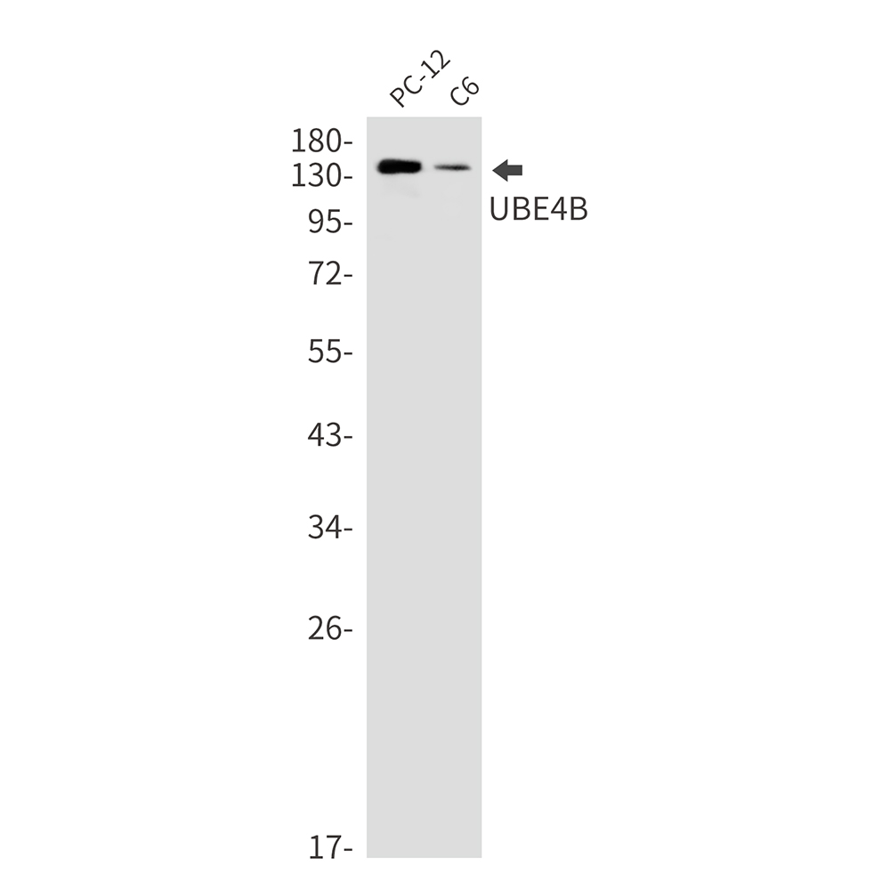 Rabbit Monoclonal Antibody to Ubiquitin Conjugation Factor E4 B