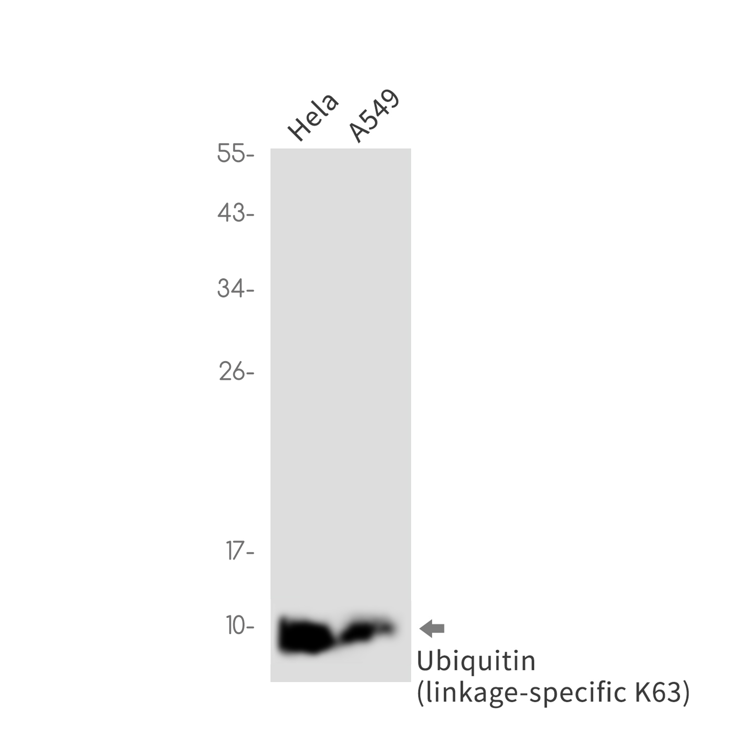 Rabbit Monoclonal Antibody to Ubiquitin K63