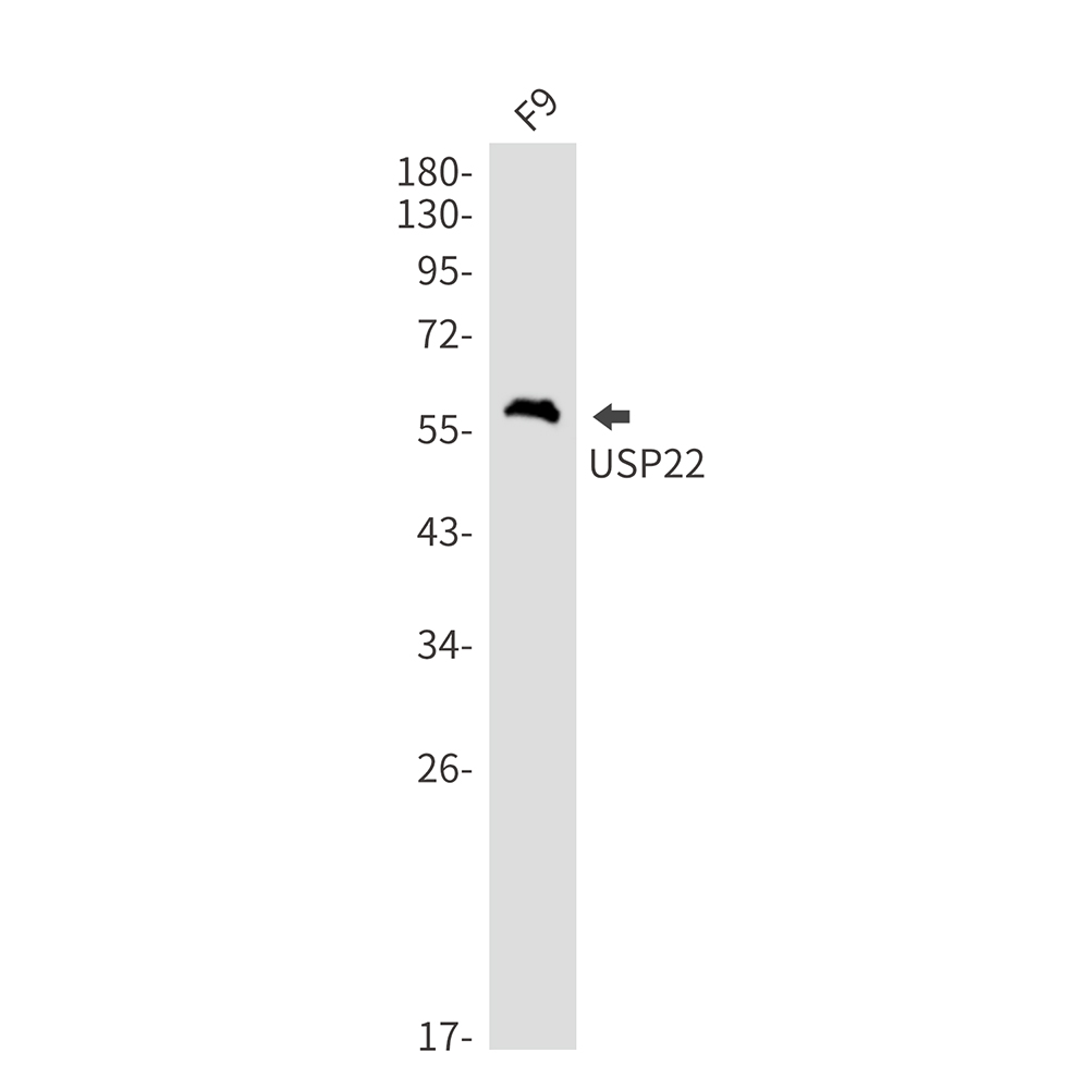 Rabbit Monoclonal Antibody to USP22
