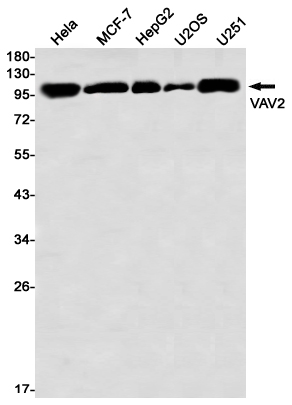 Rabbit Monoclonal Antibody to VAV2