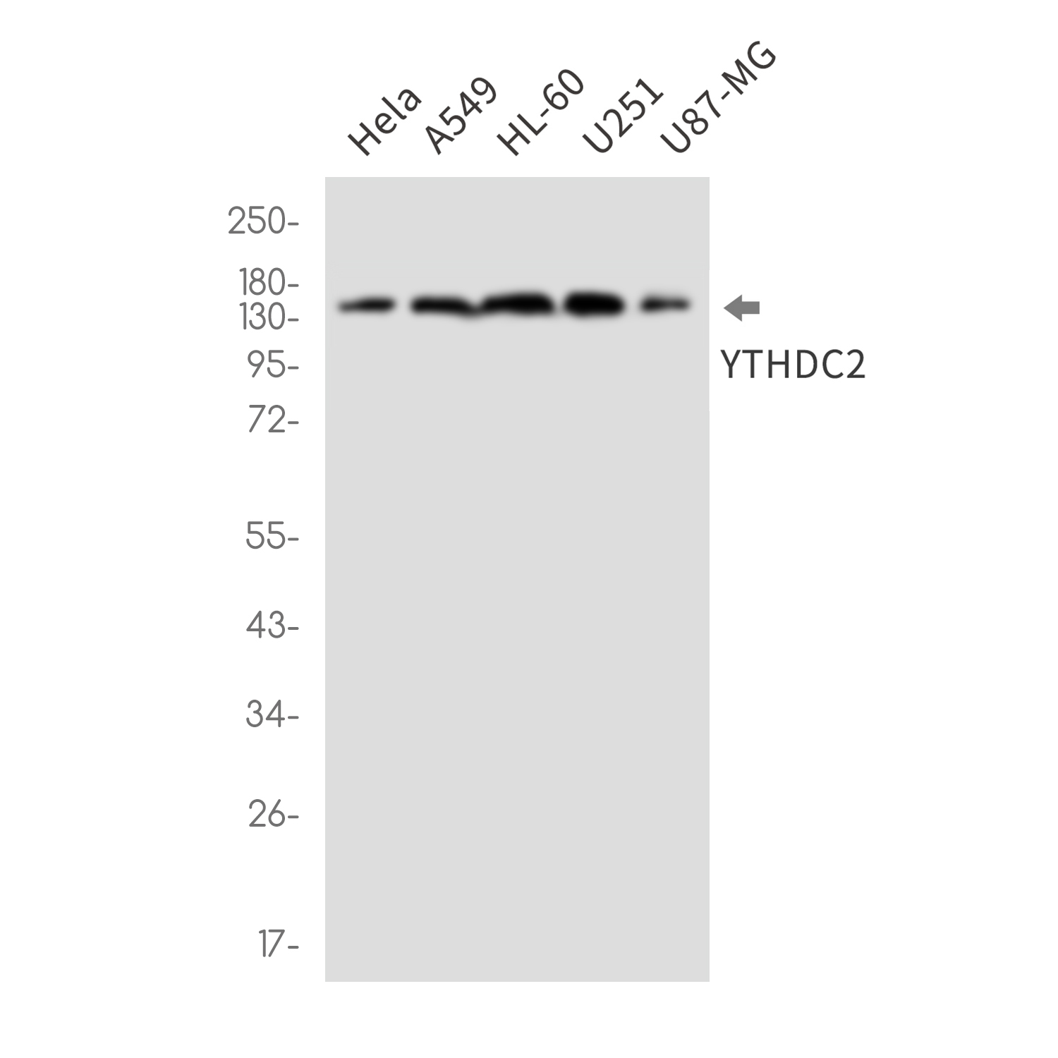 Rabbit Monoclonal Antibody to YTHDC2