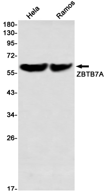 Rabbit Monoclonal Antibody to ZBTB7A