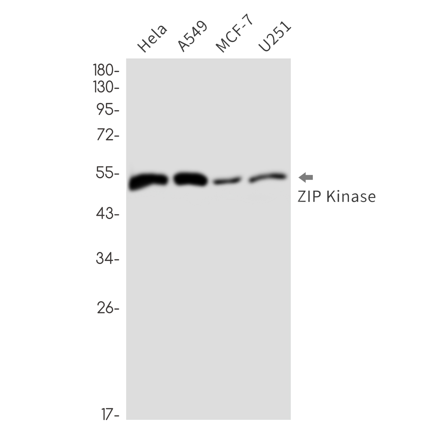 Rabbit Monoclonal Antibody to DAP kinase 3