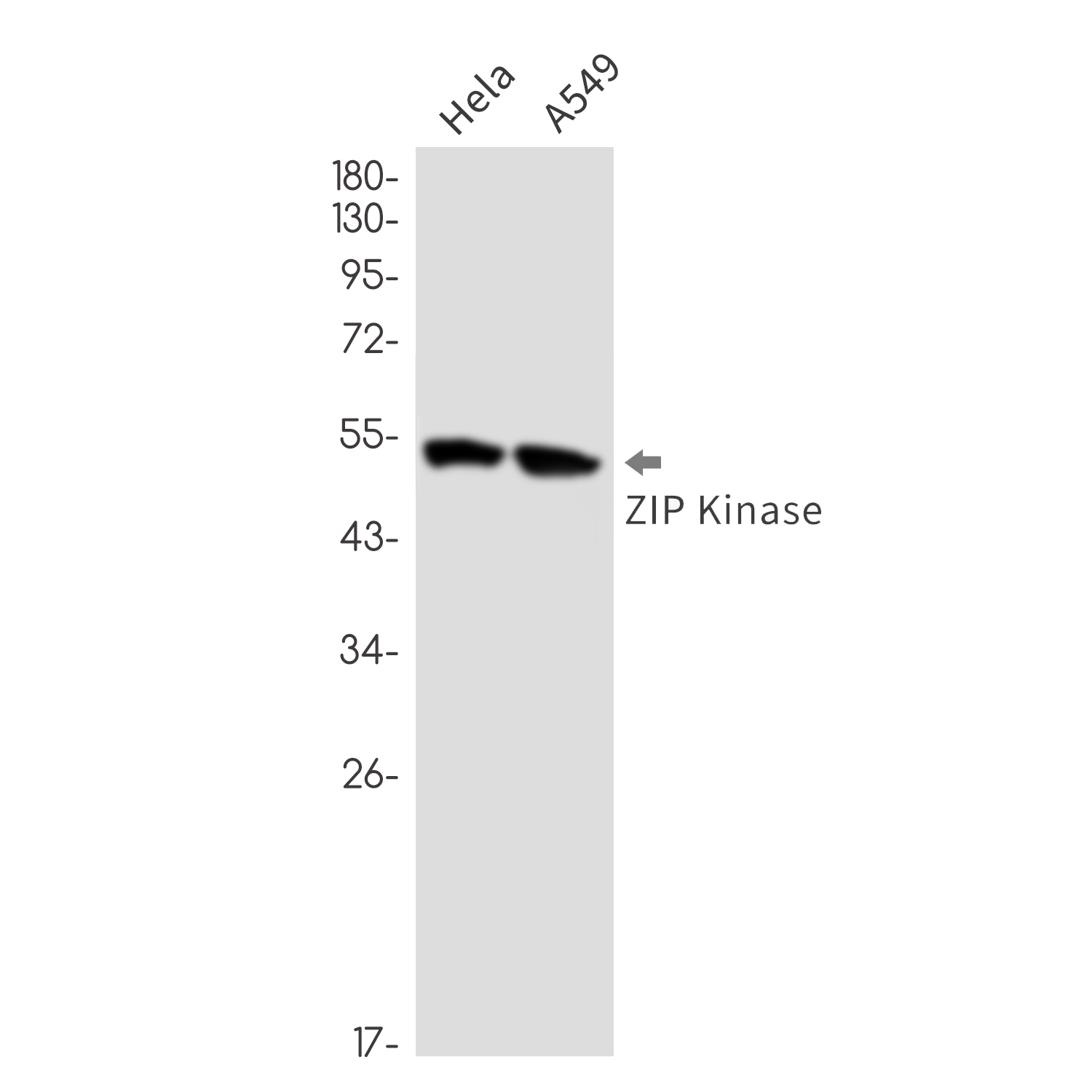 Rabbit Monoclonal Antibody to DAP kinase 3