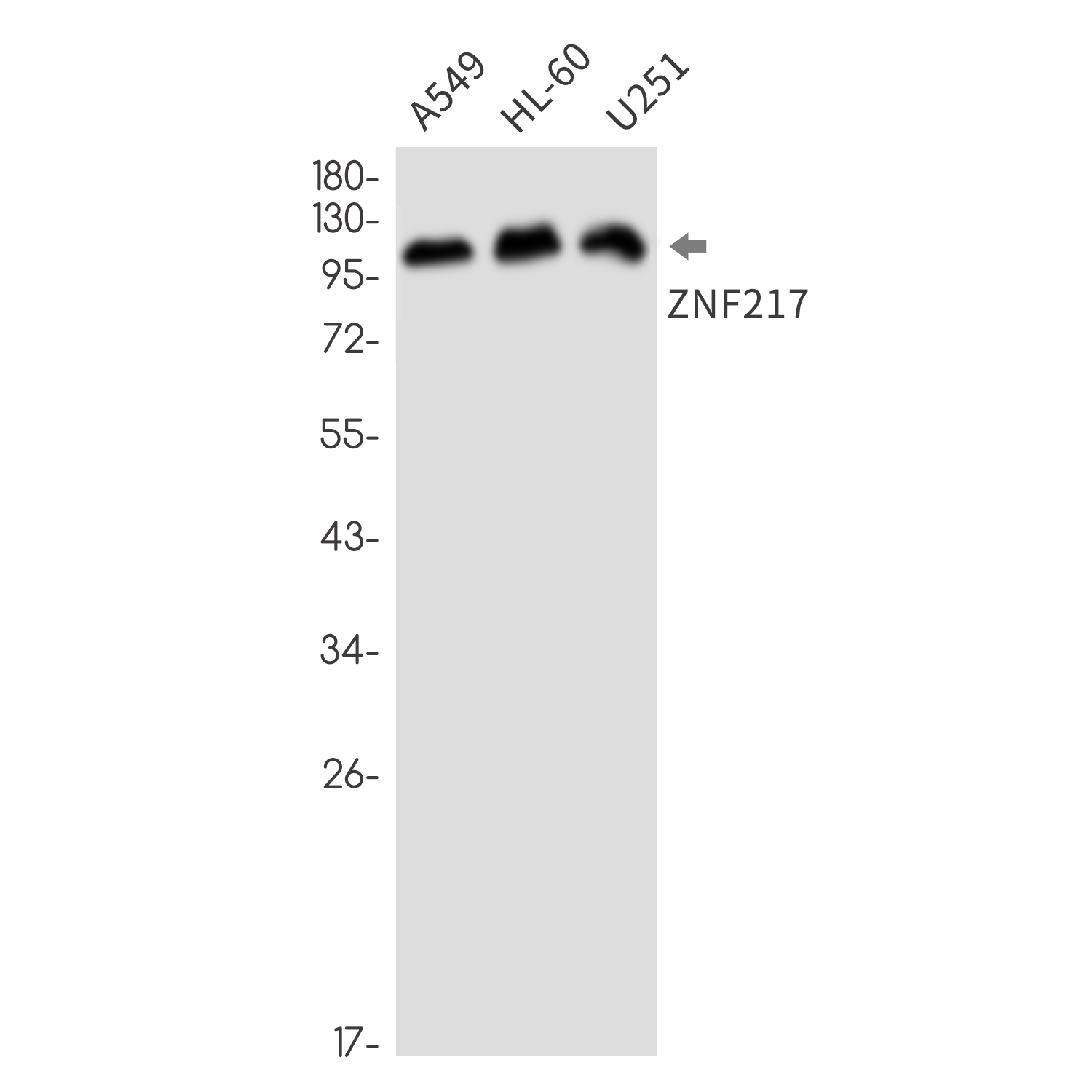 Rabbit Monoclonal Antibody to ZNF217
