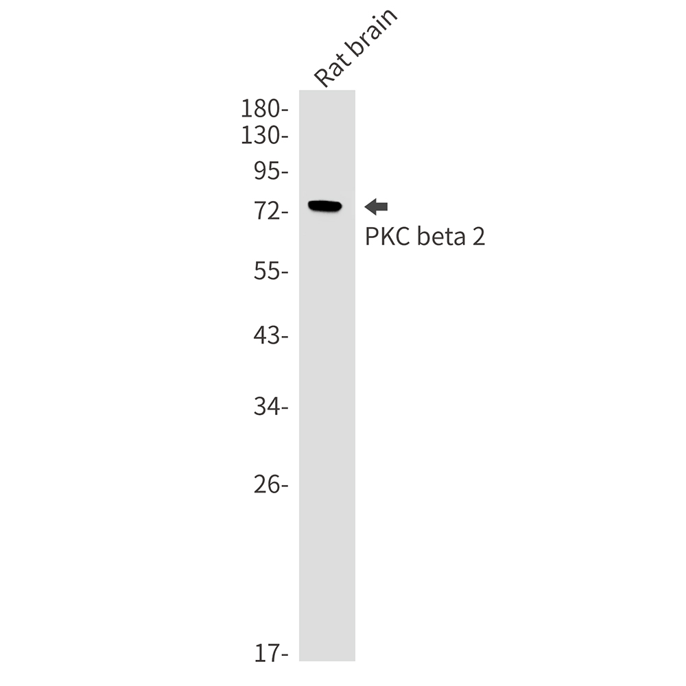 Rabbit Monoclonal Antibody to PKC beta 2