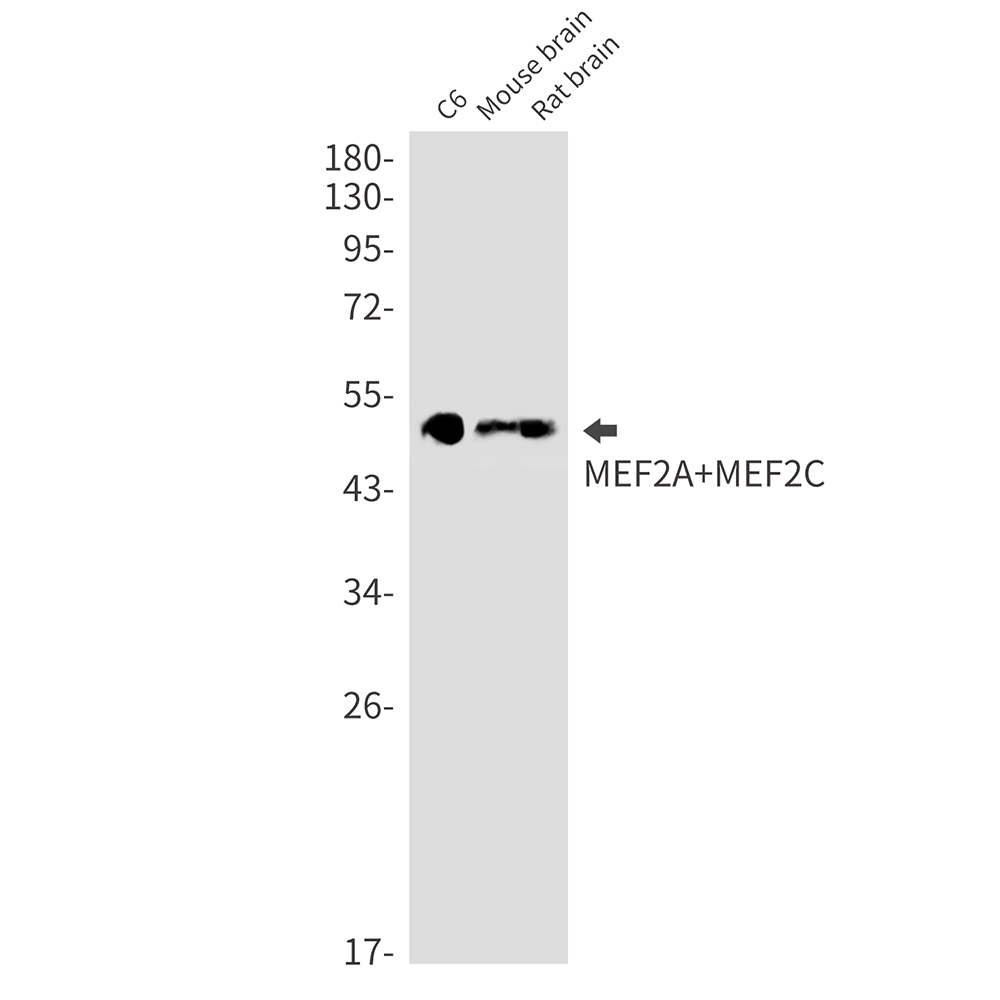 Rabbit Monoclonal Antibody to MEF2A/MEF2C