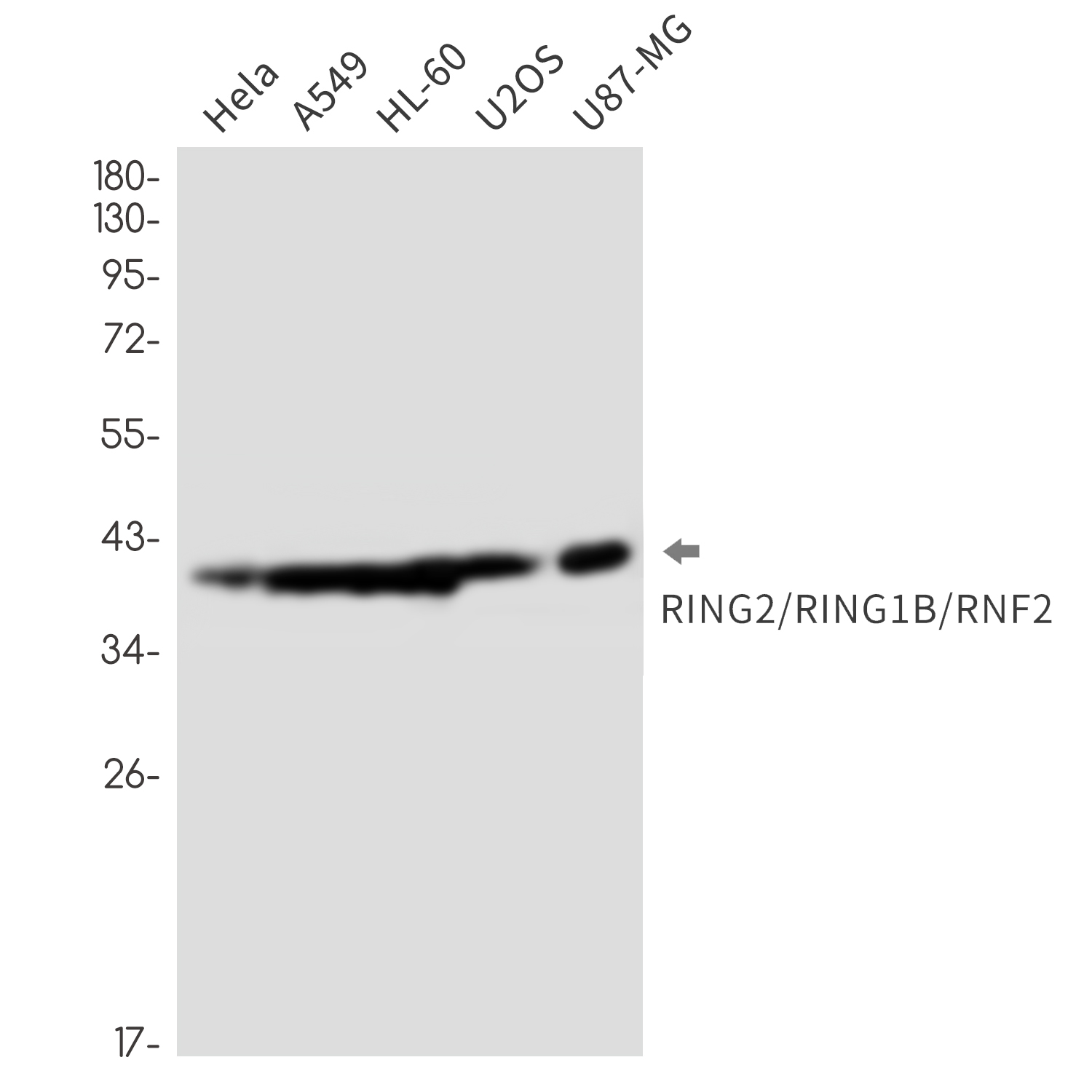 Rabbit Monoclonal Antibody to RING2