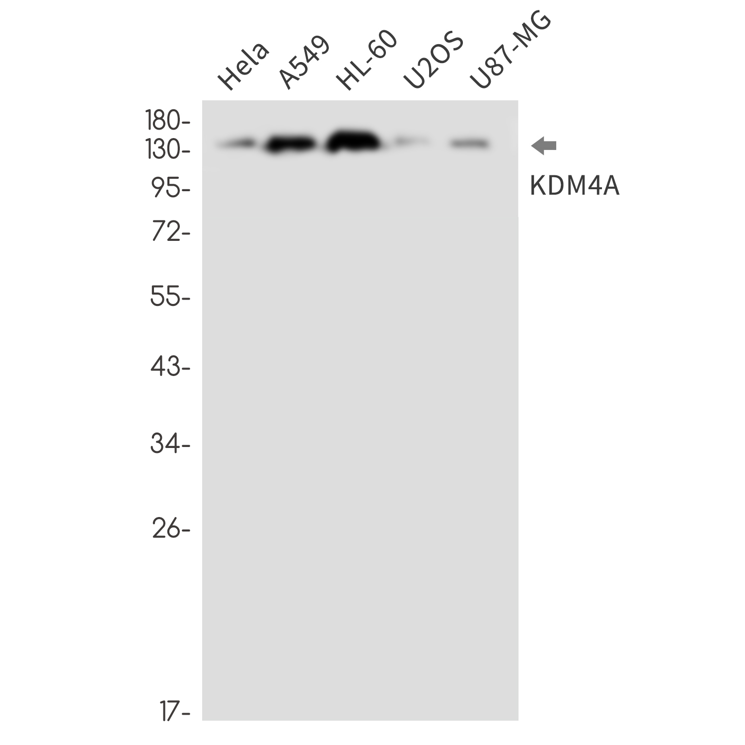 Rabbit Monoclonal Antibody to KDM4A