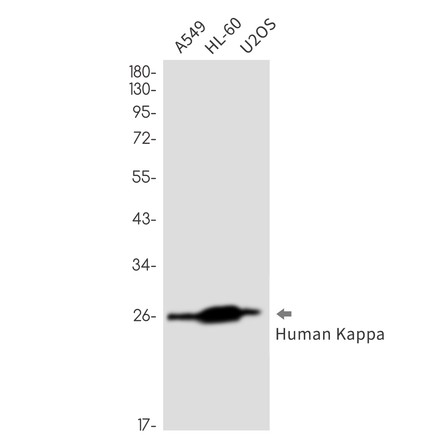 Rabbit Monoclonal Antibody to Human kappa Light Chain