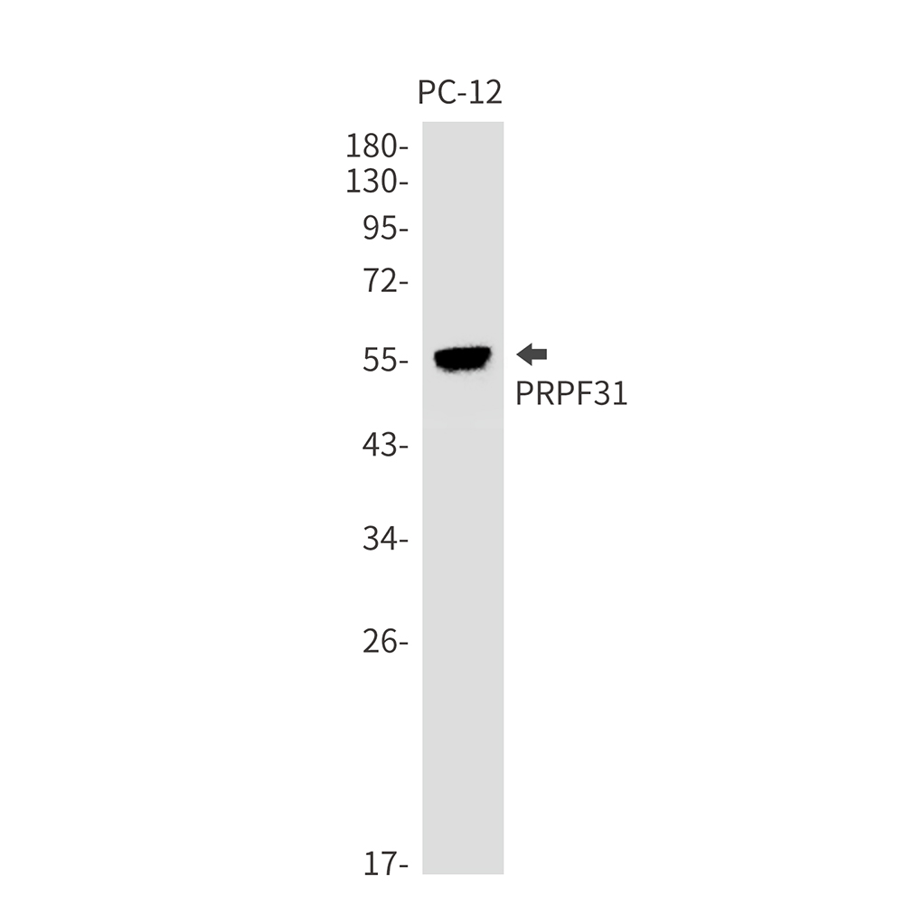 Rabbit Monoclonal Antibody to PRPF31