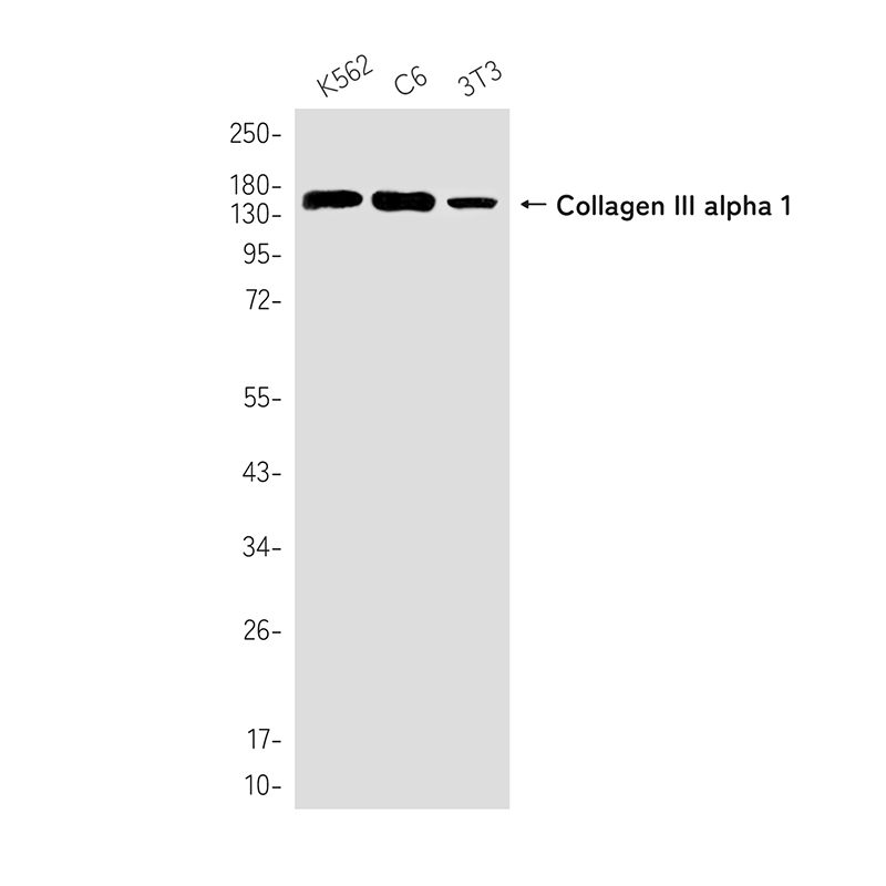 Rabbit Monoclonal Antibody to Collagen III alpha 1