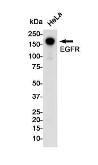 Rabbit Monoclonal Antibody to EGFR
