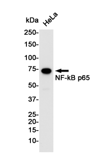 Rabbit Monoclonal Antibody to NF-KB p65