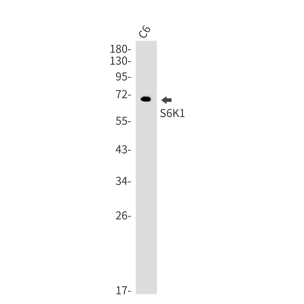 Rabbit Monoclonal Antibody to S6K1