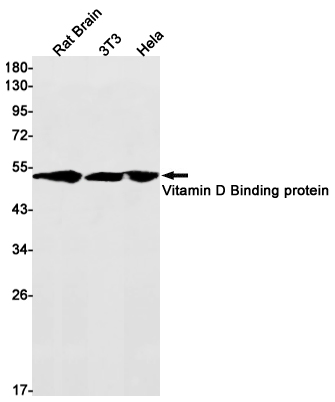 Rabbit Monoclonal Antibody to Vitamin D Binding Protein