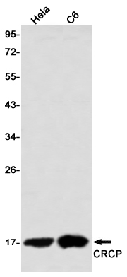Rabbit Monoclonal Antibody to CRCP