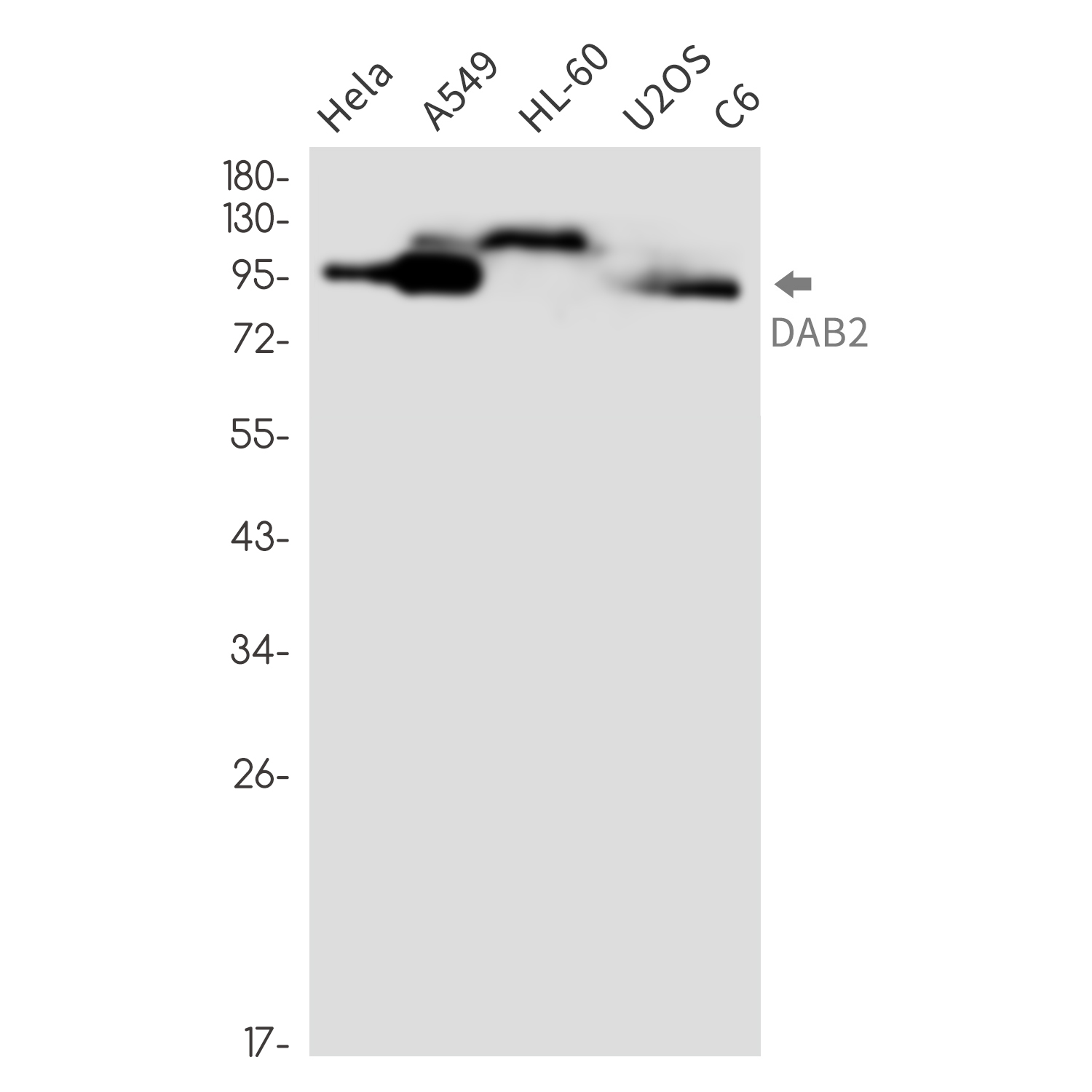 Rabbit Monoclonal Antibody to DAB2