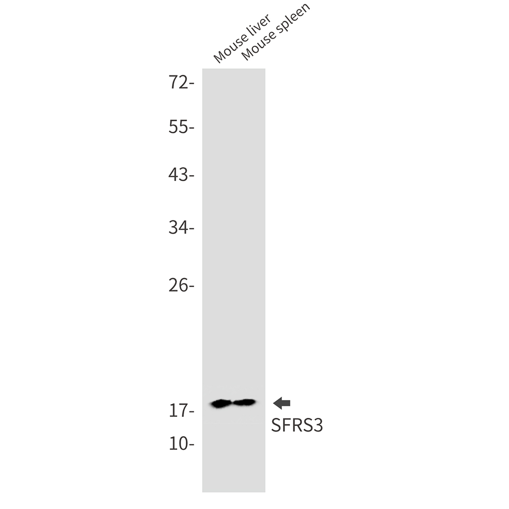Rabbit Monoclonal Antibody to SRSF3