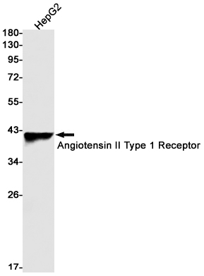 Rabbit Monoclonal Antibody to Angiotensin II Type 1 Receptor