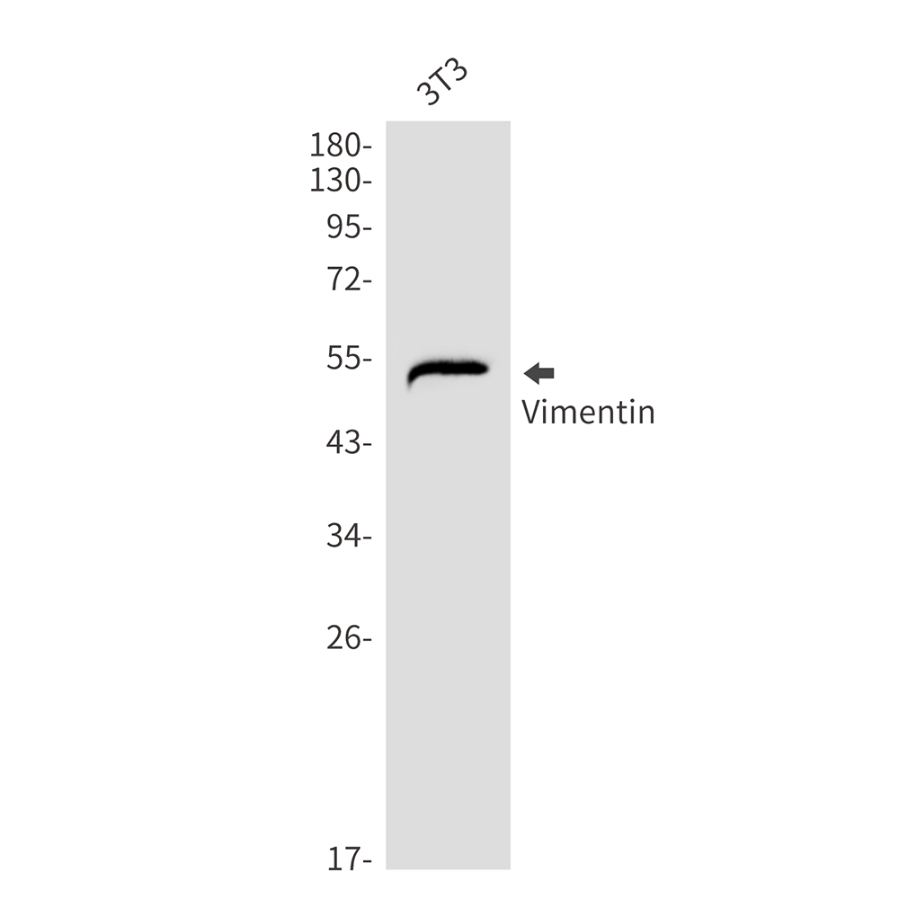 Rabbit Monoclonal Antibody to Vimentin