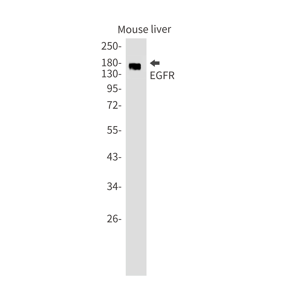 Rabbit Monoclonal Antibody to EGFR