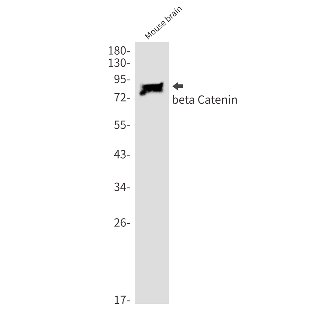 Rabbit Monoclonal Antibody to beta Catenin