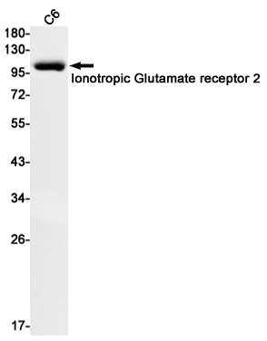 Rabbit Monoclonal Antibody to Ionotropic Glutamate Receptor 2