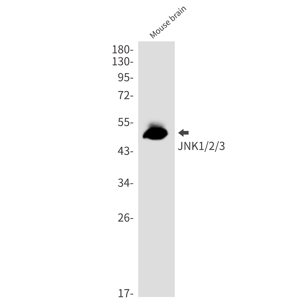 Rabbit Monoclonal Antibody to JNK