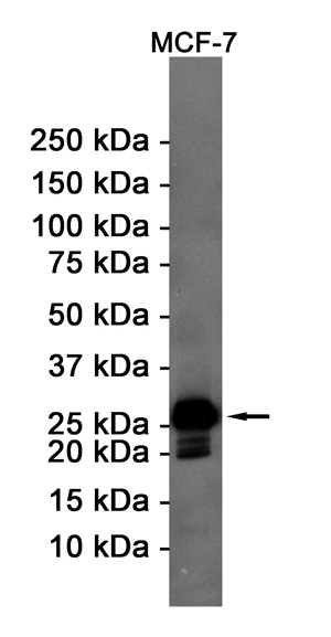 Rabbit Monoclonal Antibody to Bcl2