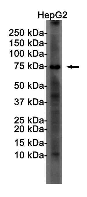 Rabbit Monoclonal Antibody to FOXO1