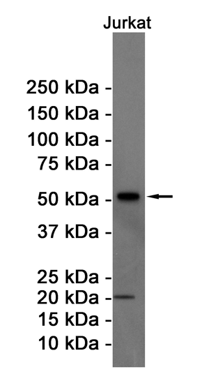 Rabbit Monoclonal Antibody to Cyclin B1