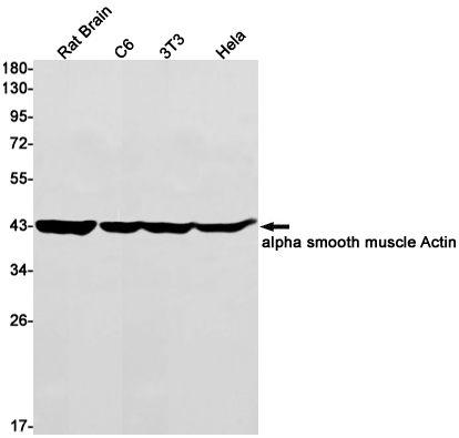 Rabbit Monoclonal Antibody to alpha Smooth Muscle Actin