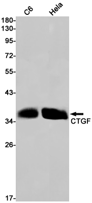 Rabbit Monoclonal Antibody to CTGF