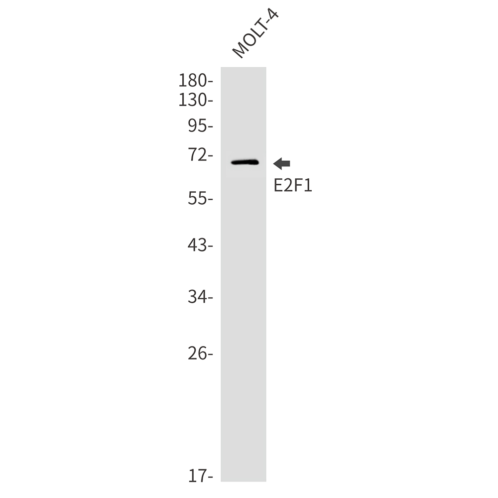Rabbit Monoclonal Antibody to E2F1
