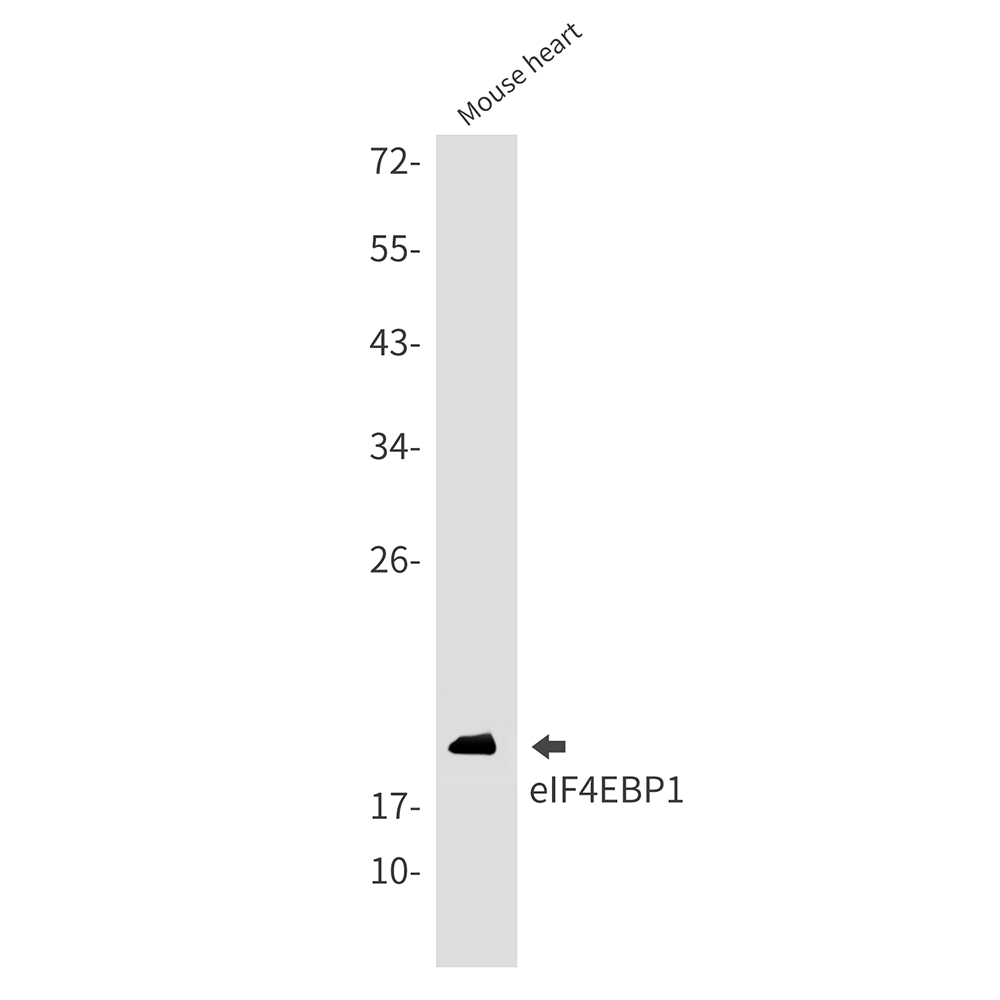 Rabbit Monoclonal Antibody to 4E BP1