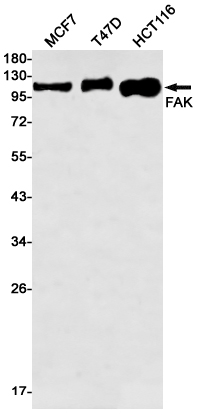 Rabbit Monoclonal Antibody to FAK