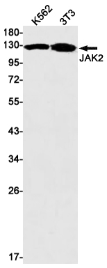 Rabbit Monoclonal Antibody to JAK2