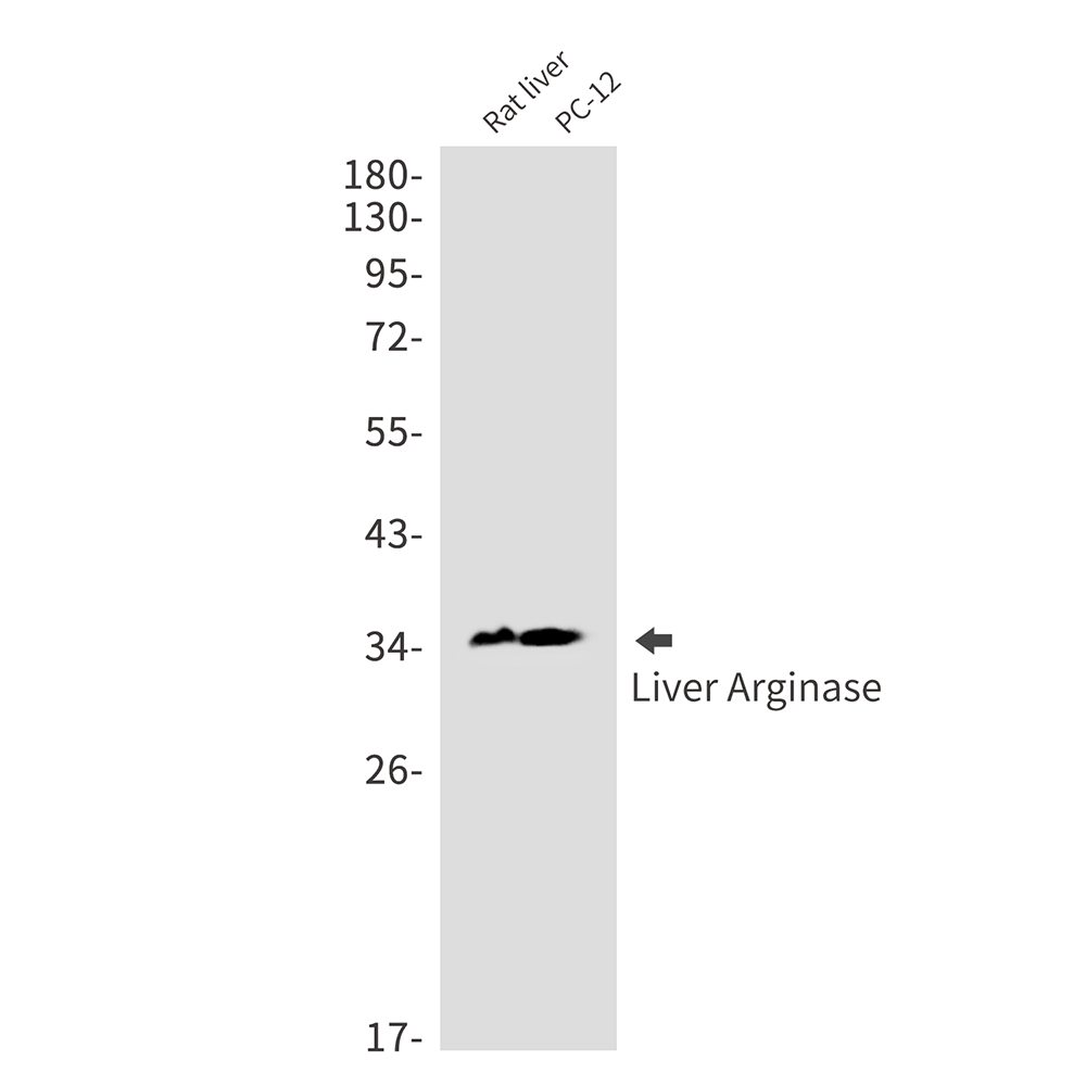 Rabbit Monoclonal Antibody to Liver Arginase