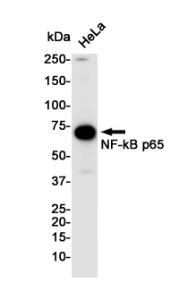 Rabbit Monoclonal Antibody to NF-KB p65