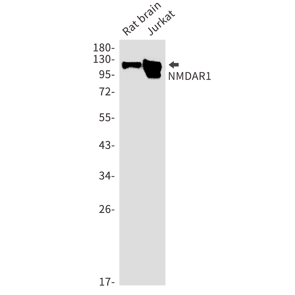 Rabbit Monoclonal Antibody to NMDAR1
