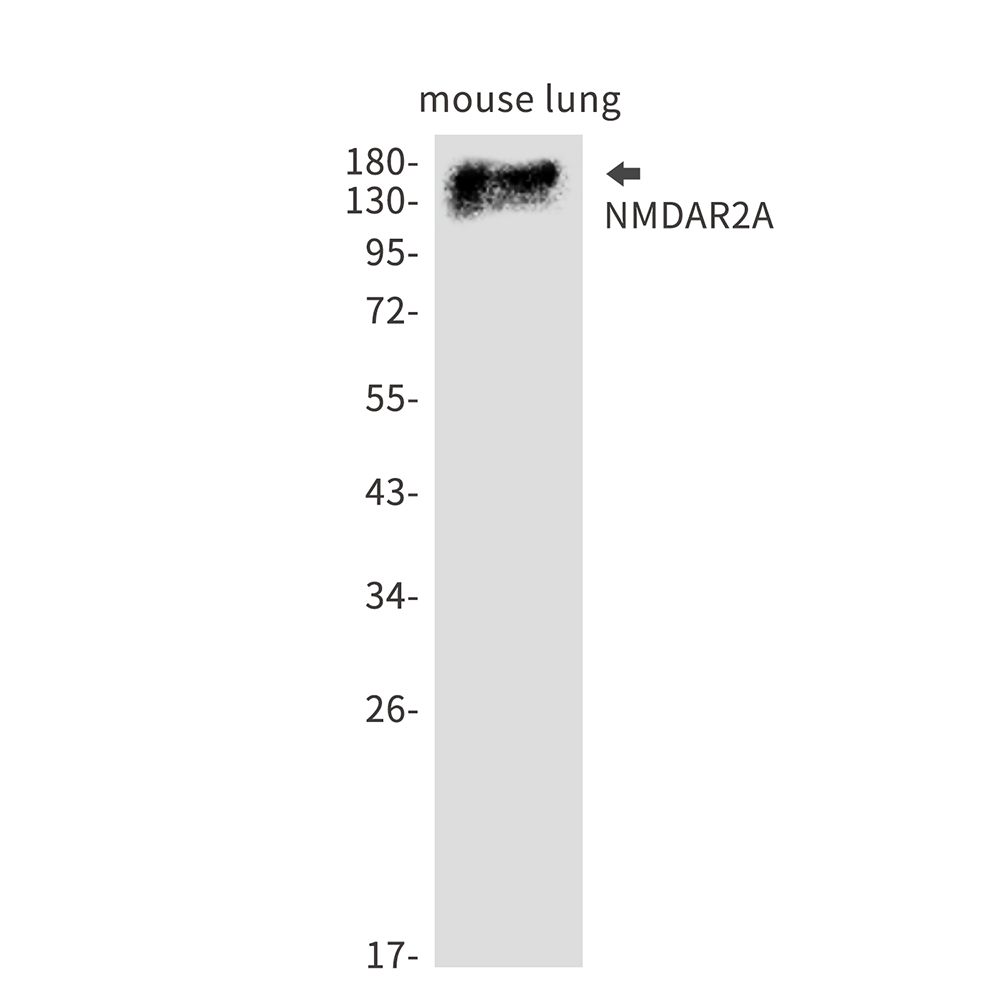 Rabbit Monoclonal Antibody to NMDAR2A