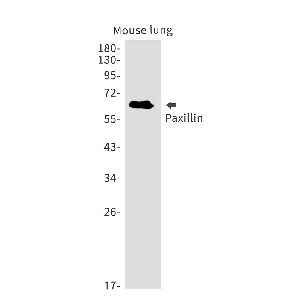 Rabbit Monoclonal Antibody to Paxillin