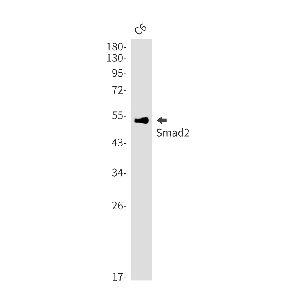 Rabbit Monoclonal Antibody to Smad2
